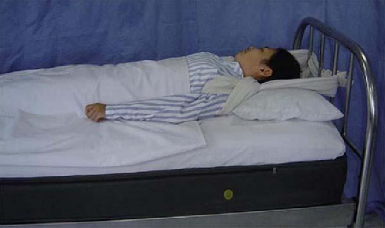 约束带,制作简单,容易对局部皮肤造成伤害,易挣脱,易被患者或其他病人